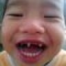 mất gương